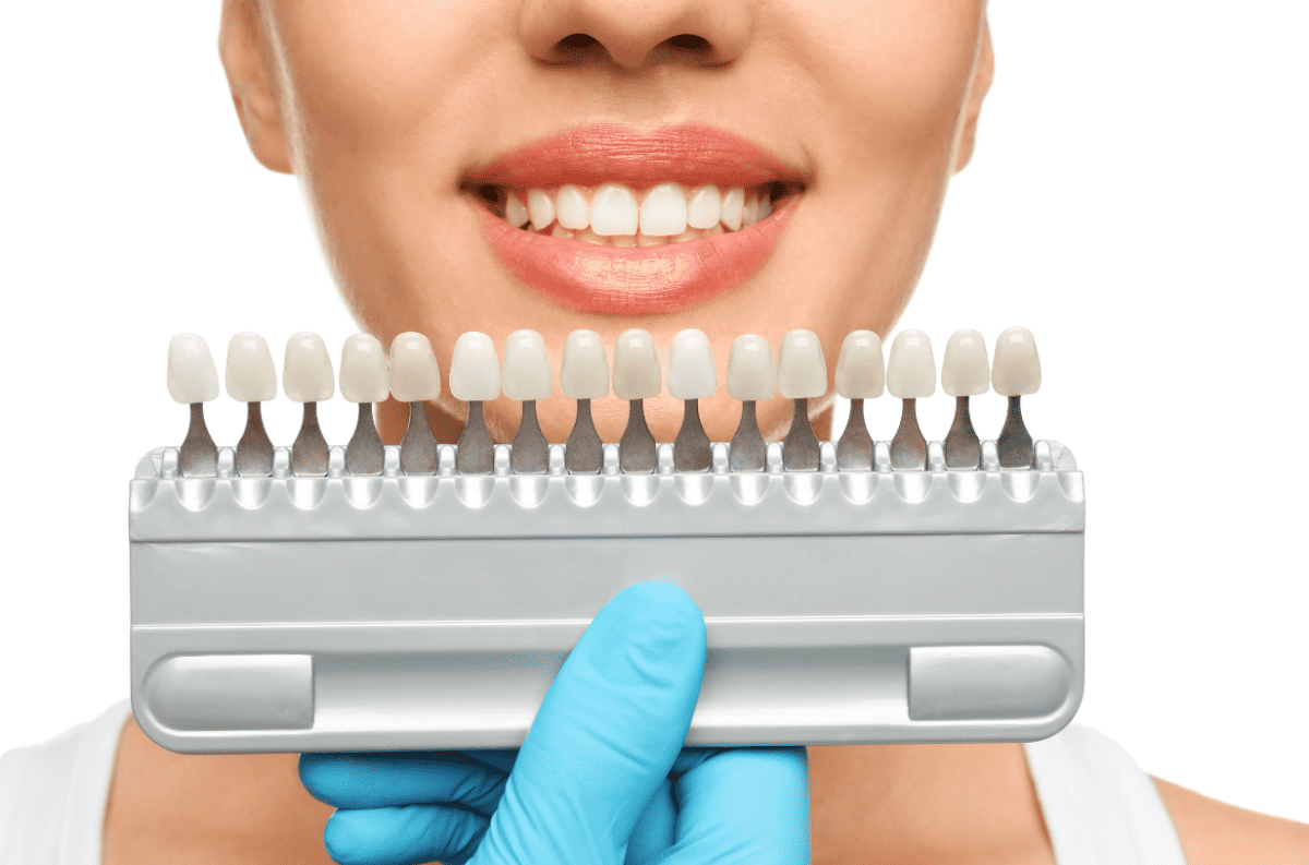 Exploring the Spectrum of Cosmetic Dentistry Procedures