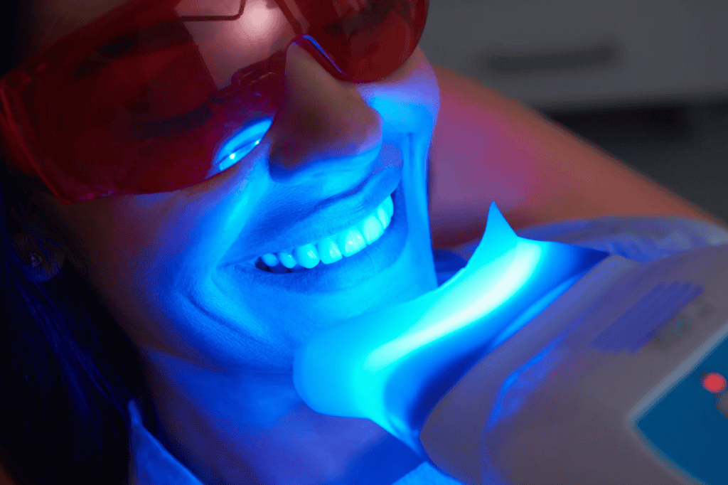 Things About Teeth Whitening