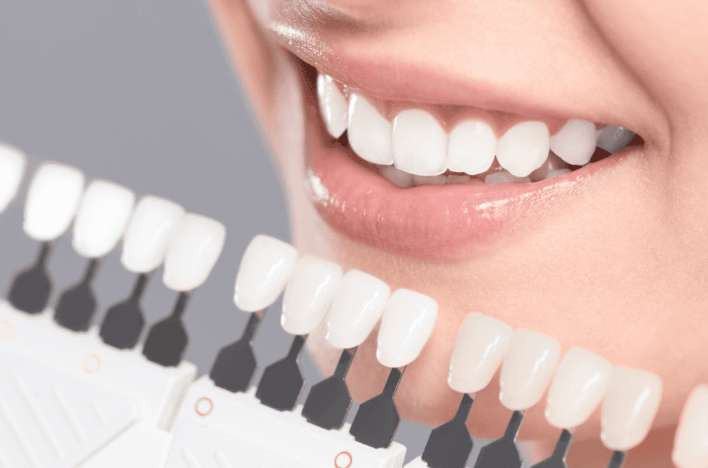 Things You Didn't Know About Teeth Whitening