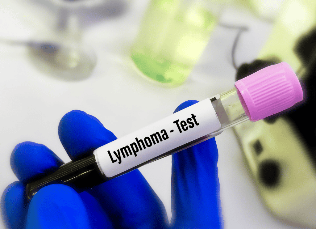 Non-Hodgkin Lymphoma Test