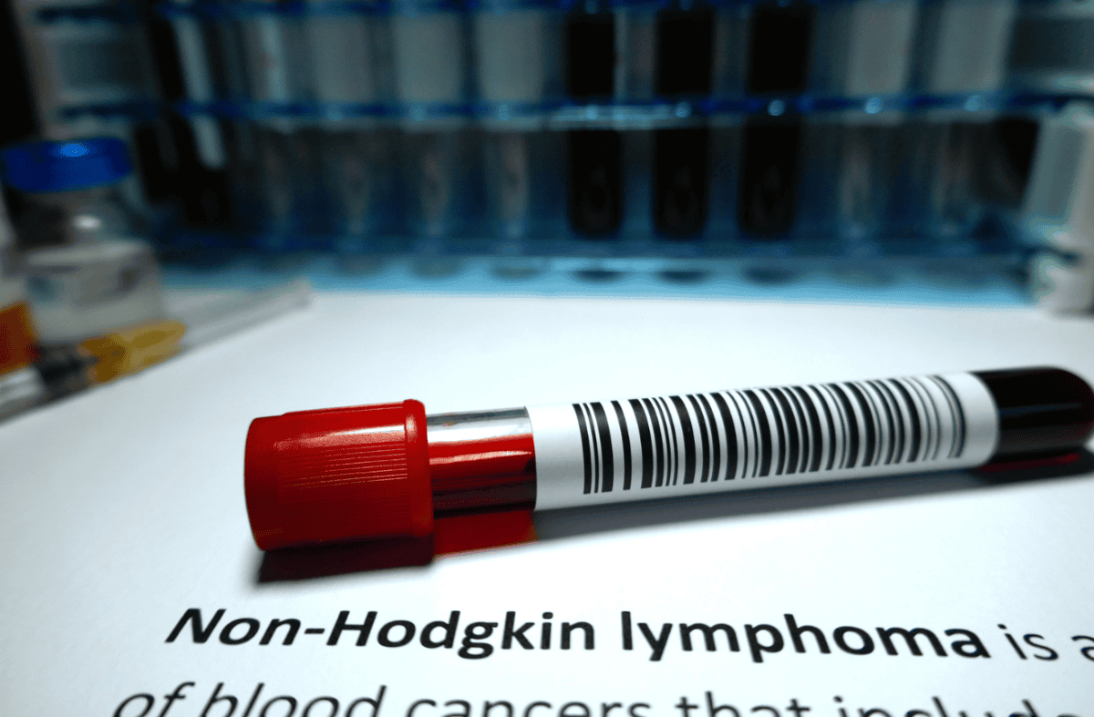 The Causes of Non-Hodgkin Lymphoma You Must Be Aware of
