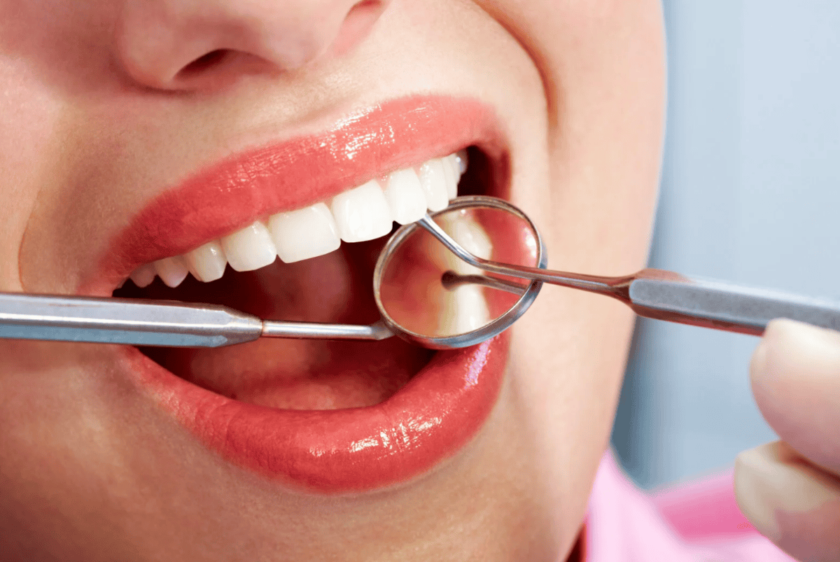 Transform Your Smile with These Dental Procedures