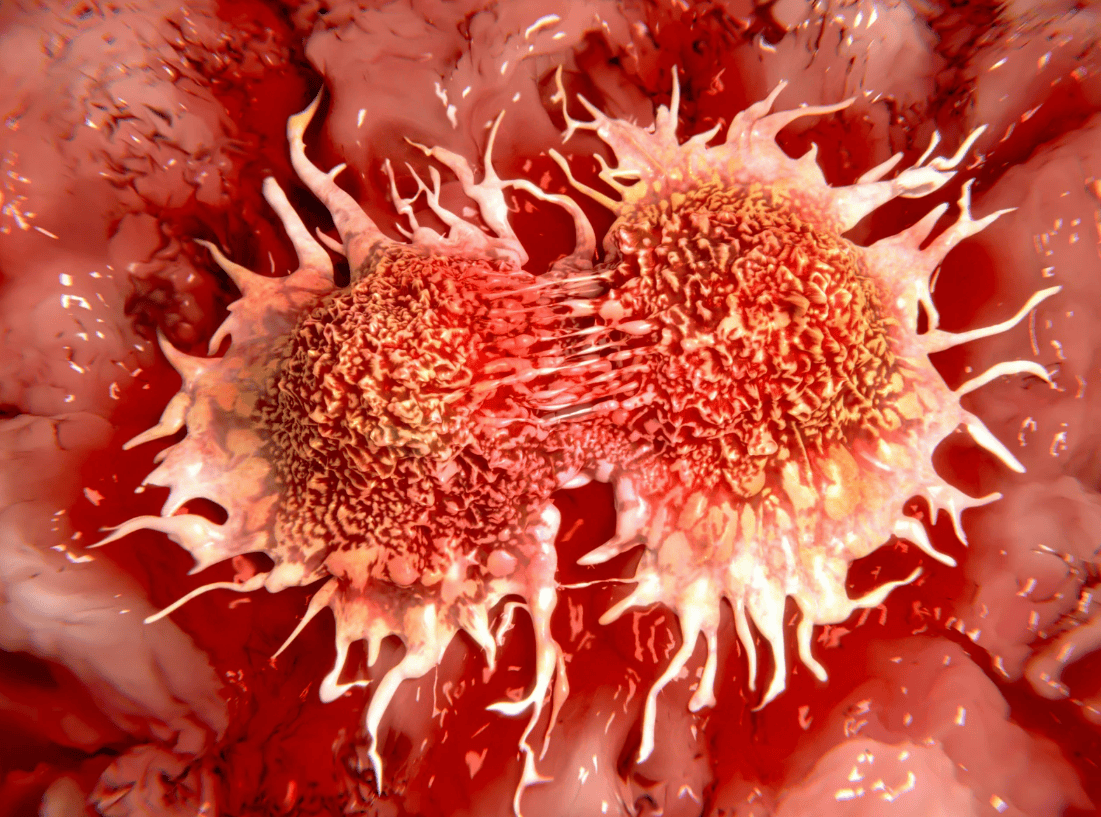 Solid Tumors