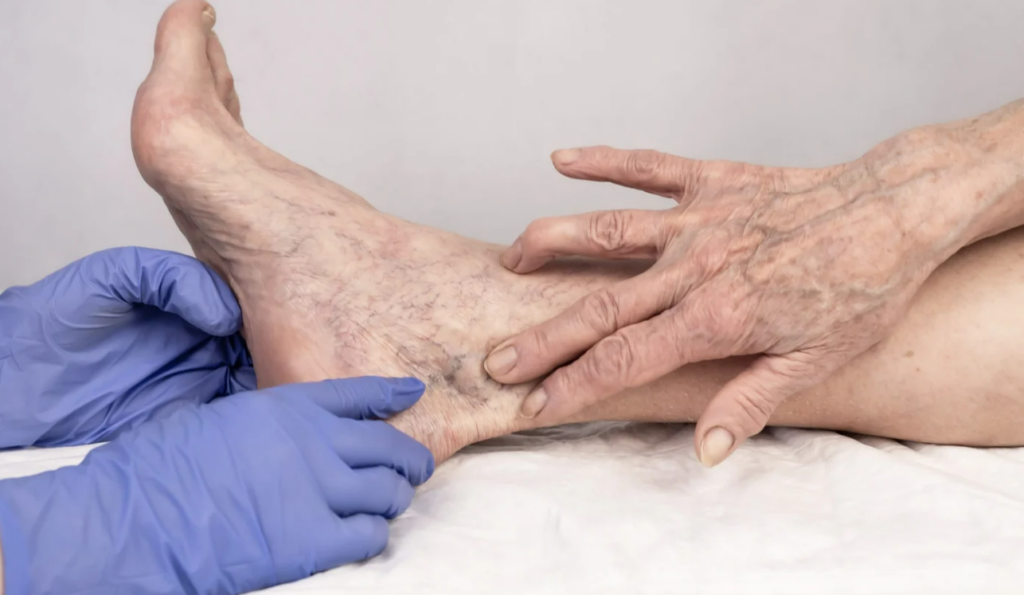 benefits of vein treatment