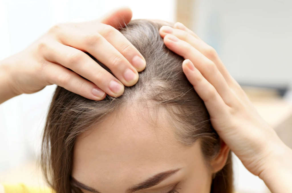 resolve thinning hair in adults