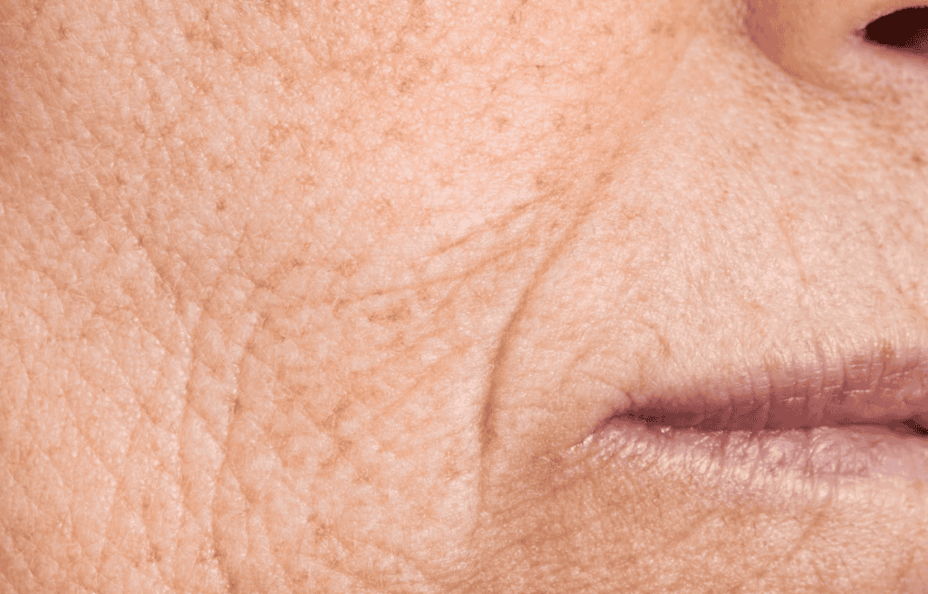 Deep Scars and Wrinkles