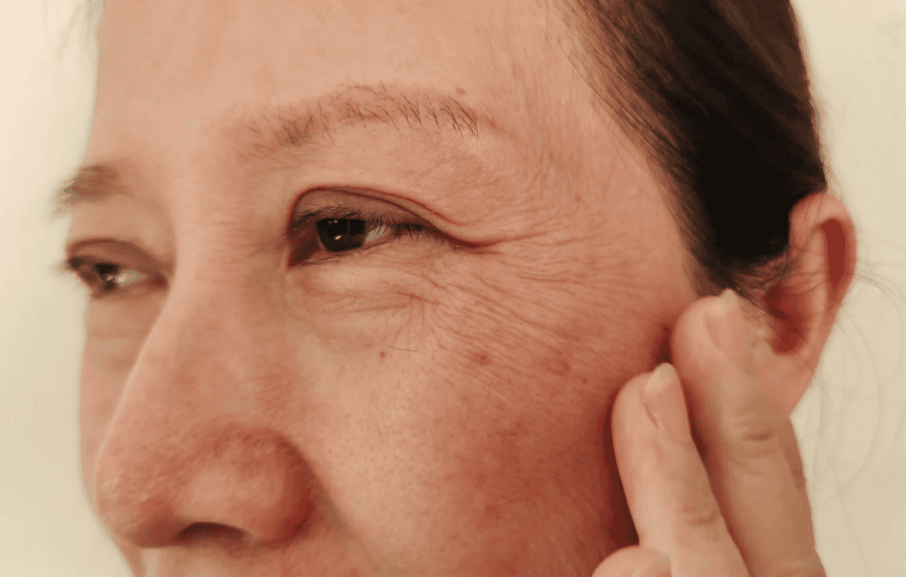 Managing Deep Scars and Wrinkles