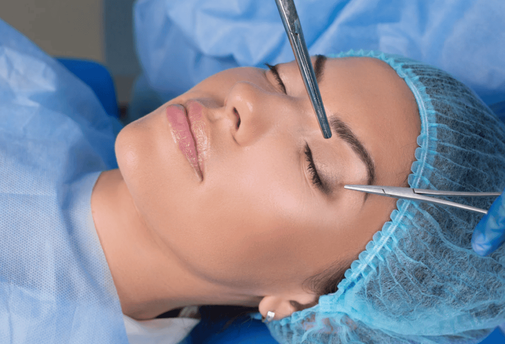 Upper Eyelid Surgery