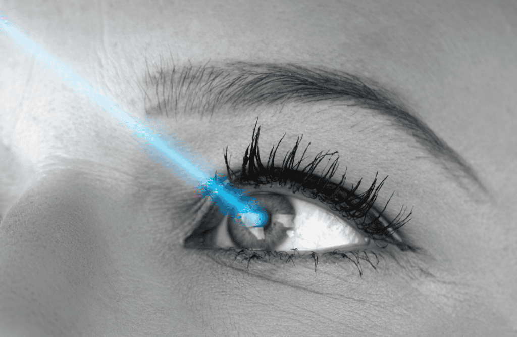 PRK for Permanent Vision Correction