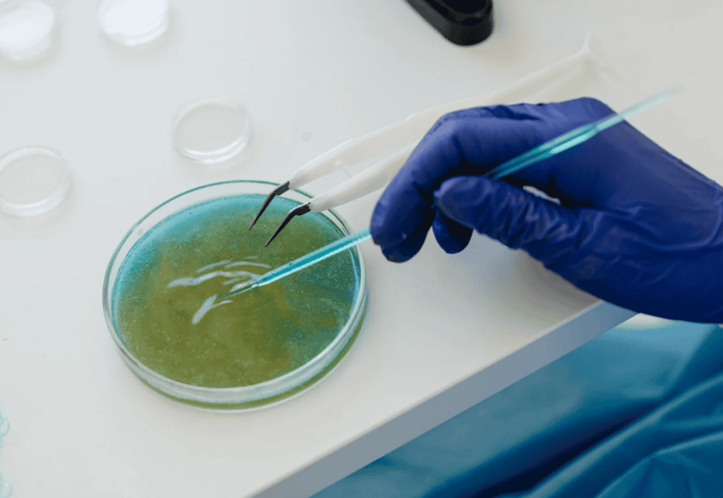 contracting severe E. coli illness