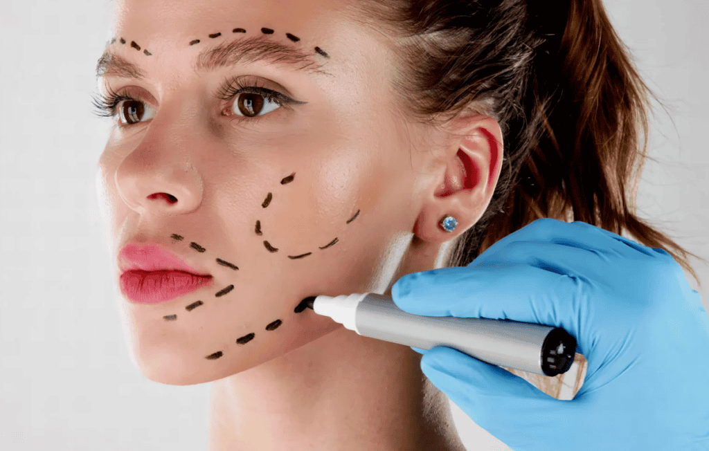 facelift in sarasota