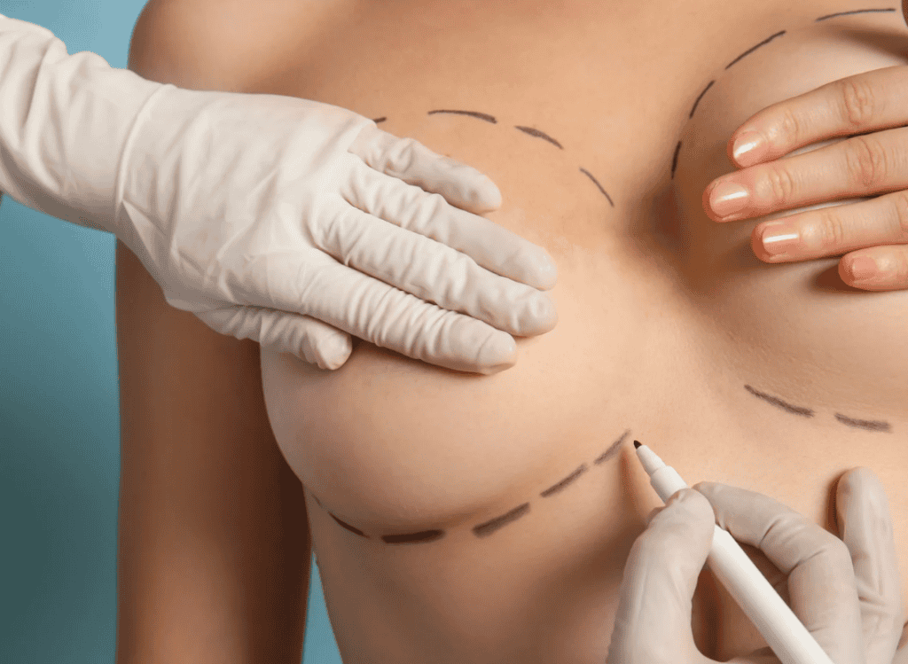 understanding breast augmentation results